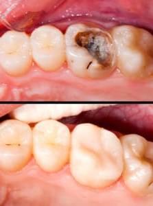 Restorative Dentistry making beautiful smiles