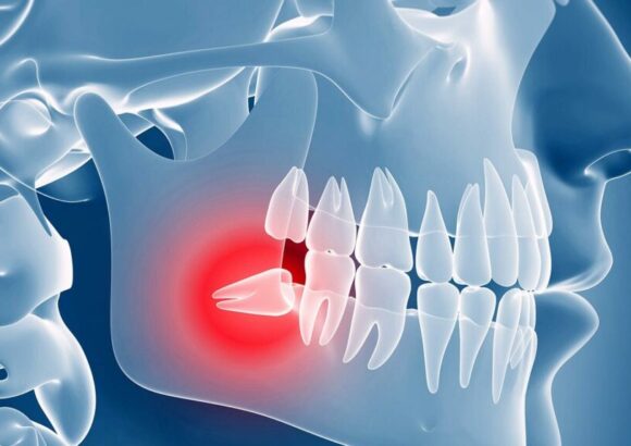 Oral and maxillofacial surgeries