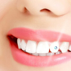 Dental art and tooth jewelry or gold  : a new upcoming aesthetic dentistry