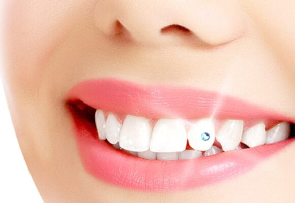 Dental art and tooth jewelry or gold  : a new upcoming aesthetic dentistry