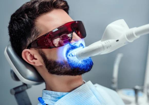 Laser teeth whitening